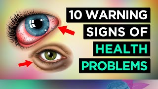 10 Warning Signs Your EYES are TELLING YOU About Your HEALTH [upl. by Dlorah]