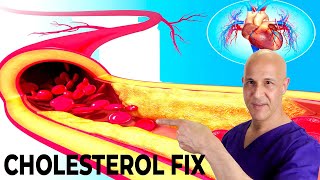 The Most Effective Way to Lower Your Cholesterol Naturally in 7 Days Dr Mandell [upl. by Temp]