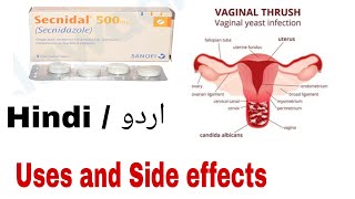 Secnidazole tablet usesSecnidazole tablet side effects review in urdu hindi [upl. by Nelda]