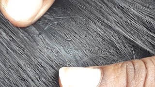 Omg fully heavy nits in hair Part 1real sounds Nitpicking in telugu prnitpickingchannel2848 [upl. by Finny]