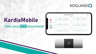 Kardia Mobile  Easy amp Reliable ECG Monitoring Anytime Anywhere [upl. by Eeneg39]