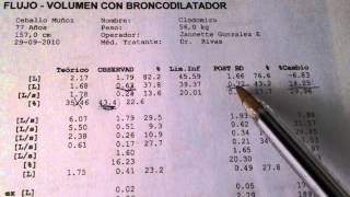 Espirometria Interpretacion Simple [upl. by Weslee]