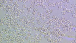 Trypanosoma brucei in mammalian blood [upl. by Airdnazxela]