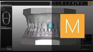 WaxupSituMirror Imaging module of ZirkonzahnModellier  ZirkonzahnSoftware [upl. by Giltzow]