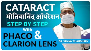 VIVITY Lens for Cataract Surgery  Alcon EDOF  Best Lens for Cataract Surgery  VIVITY IOL Review [upl. by Acisse]