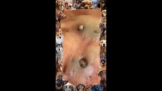 Blackhead Removal  18  Blackhead extraction  blackheads [upl. by Tildie]