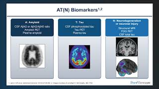 Revealing the Neuropathology of Alzheimer’s Disease Through Novel Fluid and Imaging Biomarkers [upl. by Daitzman]