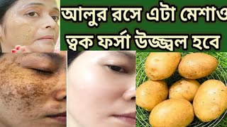 রাতে আলুর রস মিশিয়ে লাগাও কালো ত্বক একদিনে ফর্সা ধবধবে হবেForsa hobar sohoj upayPotato facial [upl. by Mark778]