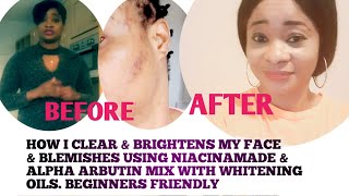 BASE CREAM FOR BEGINNERS HOW TO MAKE NIACINAMIDE amp ALPHA ARBUTIN FACE CREAM FOR SKIN LIGHTENING [upl. by Francois]