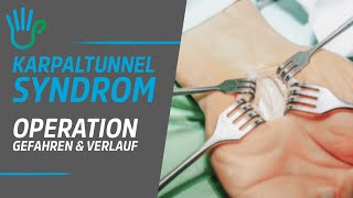 Karpaltunnelsyndrom OP  Erläuterung Ablauf amp Nachteile einer Operation [upl. by Hendrik942]