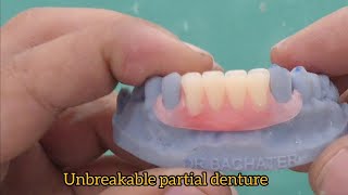 flexible removable partial denture dentistry dentaldentist flexible dentures [upl. by Calv]