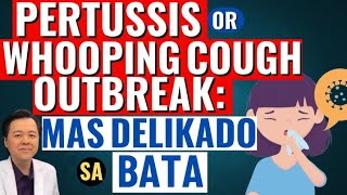 Pertussis or Whooping Cough Outbreak Mas Delikado sa Bata  Tips By Doc Willie Ong [upl. by Hanni]