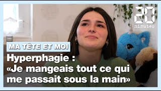 Hyperphagieboulimique  «Je mangeais tout ce qui me passait sous la main» [upl. by Aenet771]