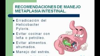 17 Gastritis Crónica Atrófica con Mataplasia Intestinal [upl. by Gwyneth]