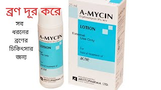 Acne Removal Lotion  AMycin Lotion  ব্রণ দূর করে  A  Mycin Lotion Full Review [upl. by Adekahs]