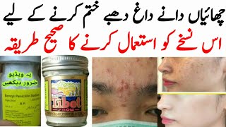 benzyl penicillin injection and tibet cream formula  Sanayya Sadique [upl. by Emmery]