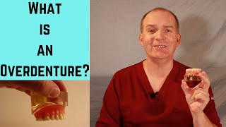 What is an Overdenture What is a snap in denture [upl. by Keverian]