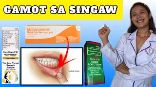 SINTOMAS DAHILAN AT GAMOT SA SINGAW SA BIBIG AT LABI  SINGAW SA BIBIG TREATMENT [upl. by Atsirtal]