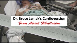 Dr Bruce Janiaks Cardioversion from Atrial Fibrillation [upl. by Htenywg979]