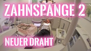 Zahnspange Teil 2  Neuer Zahnbogen  2016  Emma Sophie [upl. by Esela]