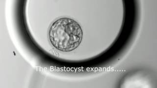 Blastocyst Development  Day 3 to Day 5 MUST SEE [upl. by Ednargel683]