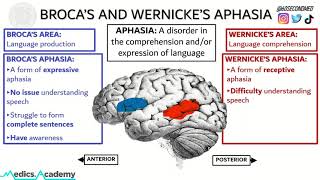 69 SECONDS on BROCAS and WERNICKES APHASIA Never get them mixed up again [upl. by Anotal]