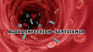 SEPSIS PATHOPHYSIOLOGY OF SEPTICEMIA [upl. by Rafiq679]