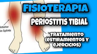 🔵 PERIOSTITIS tibial Tratamiento EJERCICIOS Y ESTIRAMIENTOS [upl. by Beyer163]