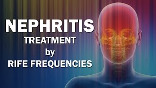 Nephritis  RIFE Frequencies Treatment  Energy amp Quantum Medicine with Bioresonance [upl. by Sumer178]