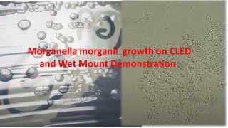 Morganella morganii Colony Morphology and Microscopy [upl. by Neyuq]