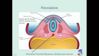 Newborn Neurological Disorders Part 2  CRASH Medical Review Series [upl. by O'Doneven741]