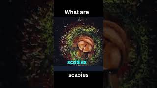 What are Scabies [upl. by Robbins294]