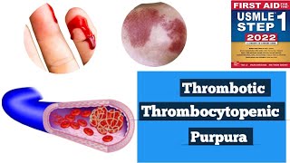 Thrombotic thrombocytopenic purpura TTPHUS Hematology lacturesDoctors goal [upl. by Itsa]