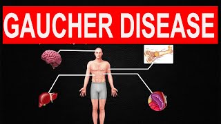 Gaucher Disease [upl. by Nnayrb]