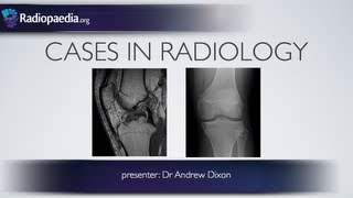 Cases in Radiology Episode 4 musculoskeletal MRI xray [upl. by Lucier919]