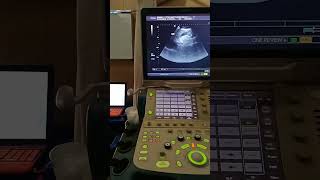 Ultrasound  Duty  Clinic  Passion  Sonologist  Radiologist  Reporting  imaging [upl. by Kenison968]