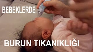 Bebek Burun Tıkanıklığını Aspiratör İle Açmak Bebek Burun Temizliği [upl. by Rodd]