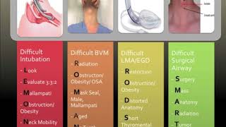 Pre Intubation Airway Assessment [upl. by Ecidnac]