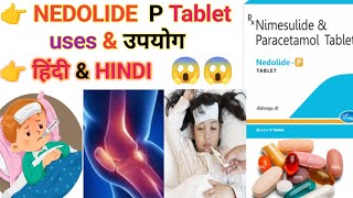 😱 NEDOLIDE P 👉 TABLET USES in hindi nedolide p tablet uses in hindi viralvideotabletscapsules [upl. by Athallia]