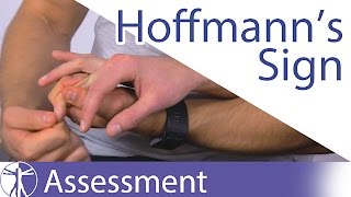 Hoffmanns Sign or Reflex  Upper Motor Neuron Lesion [upl. by Inobe]