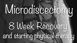 Microdiscectomy Recovery  8 Weeks and starting Physical Therapy [upl. by Jacobs]