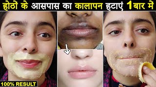 How to Remove Dark Black Patches Dark Spots amp Pigmentation Around Mouth  Remove Upper Lip Darkness [upl. by Swithbert]