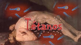 Tétanos Clostridium tetani [upl. by Nelra]