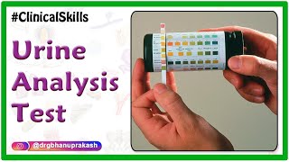 Urine analysis test procedure  Biochemistry Practicals [upl. by Annas115]