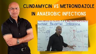 Clindamycin vs Metronidazole  Anaerobic Infections [upl. by Primaveras673]