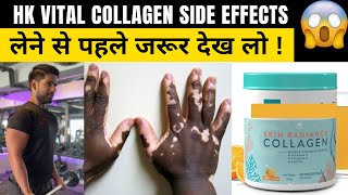 HK VITAL COLLAGEN REVIEWSIDE EFFECTS 😥  HK VITAL COLLAGEN Results 🔥  लेने से पहले देख लो [upl. by Ellerol299]