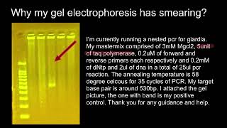 What taq polymerase 1 unit means [upl. by Reel659]