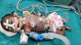 newborn emergencyelectrode placementEt suction 😞ytshorts viral newbornnicu emergencybabycare [upl. by Curry97]