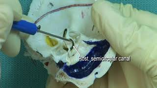 17 Step 6 Position and orientation of the semicircular canals [upl. by Gunning]