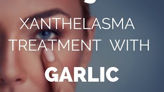 Xanthelasma treatment with garlic does it work [upl. by Sussi92]